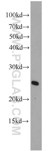 [10312-1-AP-150UL] ARL4 Polyclonal antibody