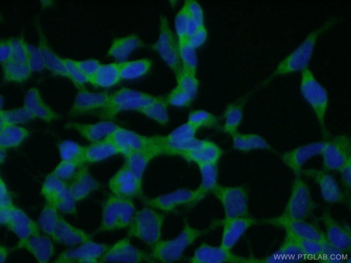 [10313-1-AP-20UL] CNOT2 Polyclonal antibody