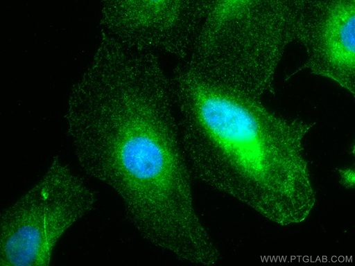 [10314-1-AP-20UL] Stanniocalcin 2 Polyclonal antibody