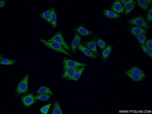 [10315-1-AP-150UL] Cathepsin H Polyclonal antibody