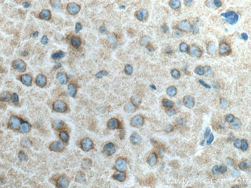 [10317-1-AP-20UL] CRMP1 Polyclonal antibody