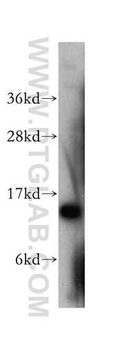 [10318-1-AP-20UL] SMA4 Polyclonal antibody
