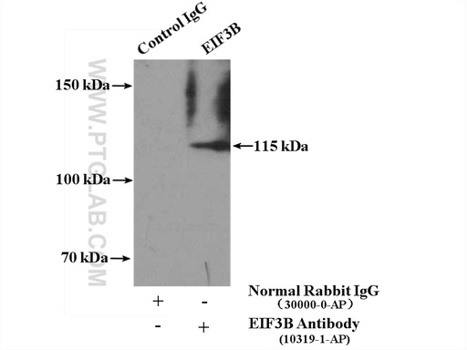 [10319-1-AP-150UL] EIF3B Polyclonal antibody