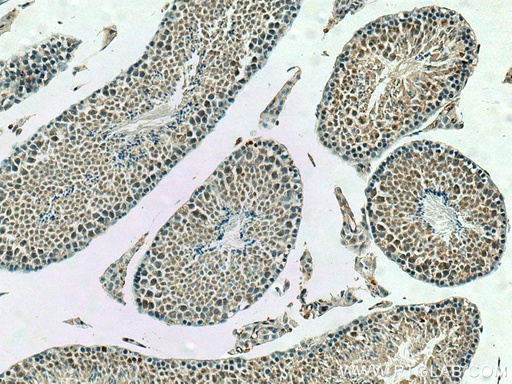 [10321-1-AP-150UL] PPP2R4 Polyclonal antibody