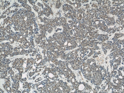 [10322-1-AP-150UL] NUDT21 Polyclonal antibody