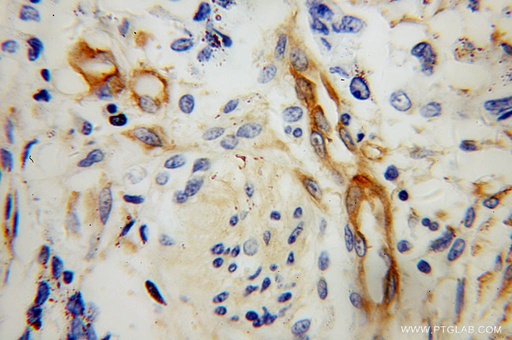 [10324-1-AP-20UL] MYL12B Polyclonal antibody