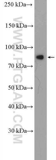[10330-1-AP-20UL] Zyxin Polyclonal antibody
