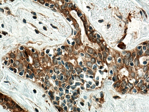 [10331-1-AP-150UL] RARA Polyclonal antibody