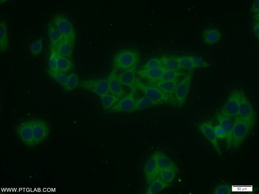 [10332-1-AP-150UL] TRAIP Polyclonal antibody