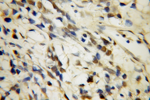 [10334-1-AP-150UL] U2AF35 Polyclonal antibody