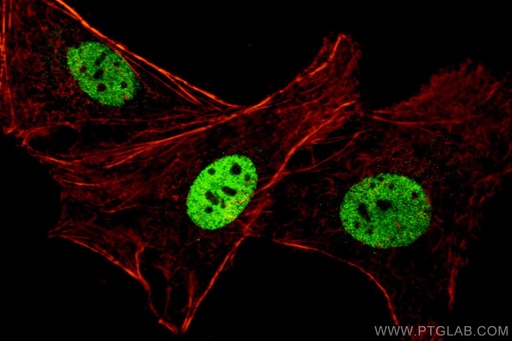 [10336-1-AP-20UL] PAX8 Polyclonal antibody