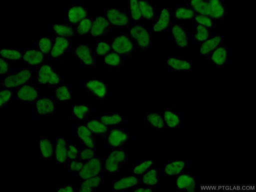 [10337-1-AP-20UL] MAD2L1 Polyclonal antibody