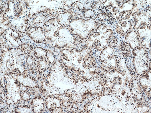 [10341-1-AP-150UL] ACTL6A Polyclonal antibody