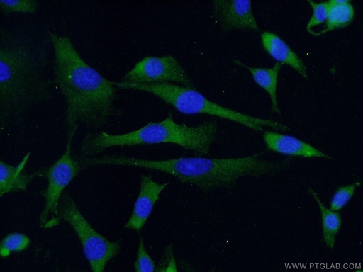 [10347-1-AP-20UL] RAB4A Polyclonal antibody