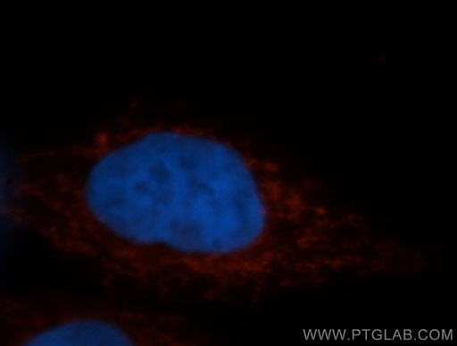 [10348-1-AP-150UL] STOML2 Polyclonal antibody