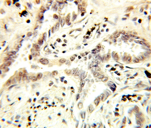 [10349-1-AP-150UL] NCBP1 Polyclonal antibody