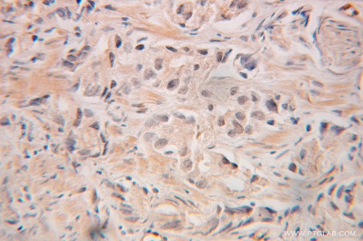[10354-1-AP-150UL] GRWD1 Polyclonal antibody