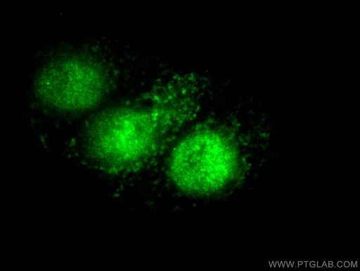 [10355-1-AP-150UL] P21 Polyclonal antibody