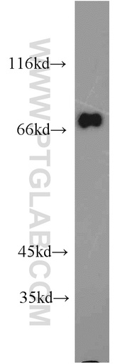 [10356-1-AP-150UL] GGA2 Polyclonal antibody