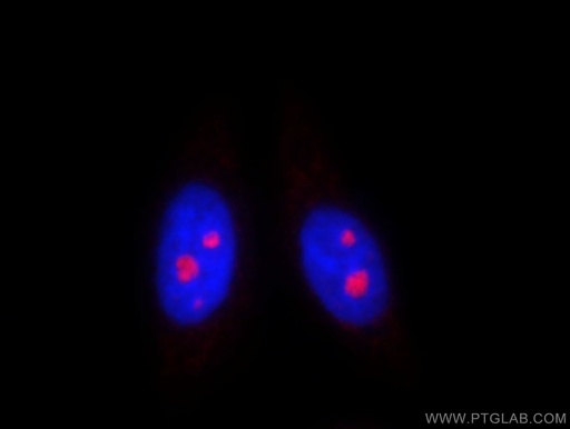 [10358-1-AP-150UL] DDX50 Polyclonal antibody