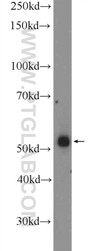 [10360-1-AP-150UL] ZNF256 Polyclonal antibody