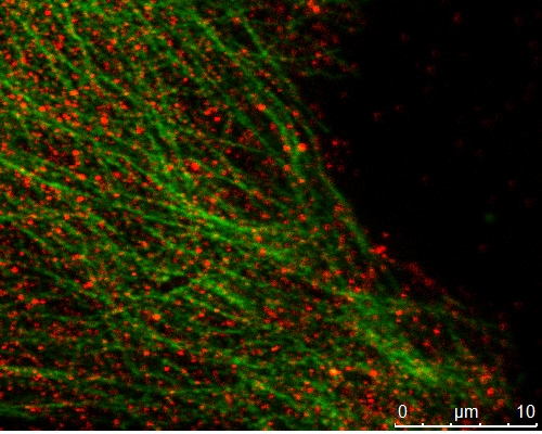 [10364-1-AP-150UL] MAPRE2 Polyclonal antibody