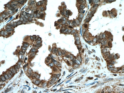 [10368-1-AP-20UL] ALDH7A1 Polyclonal antibody
