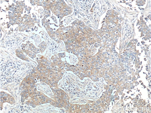 [10369-1-AP-20UL] ERBB3 Polyclonal antibody