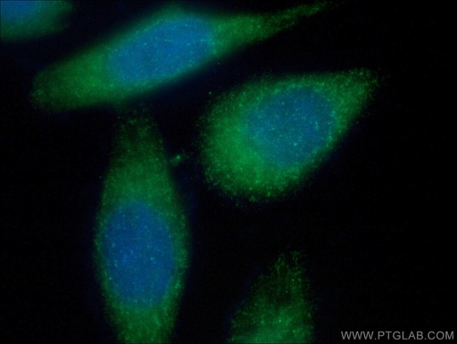 [10373-2-AP-20UL] MMP2 Polyclonal antibody