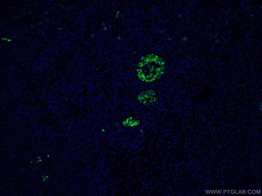[10374-2-AP-20UL] MMP7 Polyclonal antibody