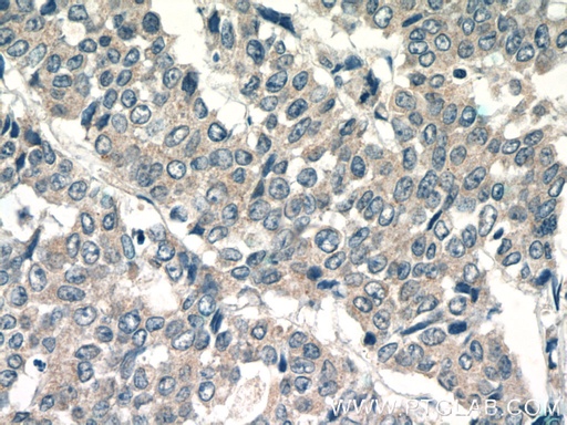 [10376-1-AP-20UL] LPO Polyclonal antibody