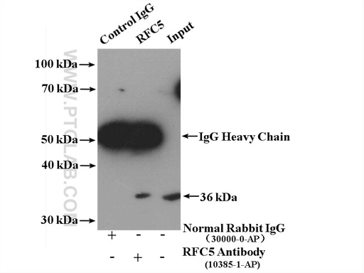 [10385-1-AP-20UL] RFC5 Polyclonal antibody