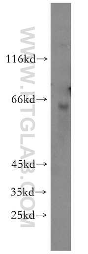 [10386-1-AP-150UL] KRBP Polyclonal antibody