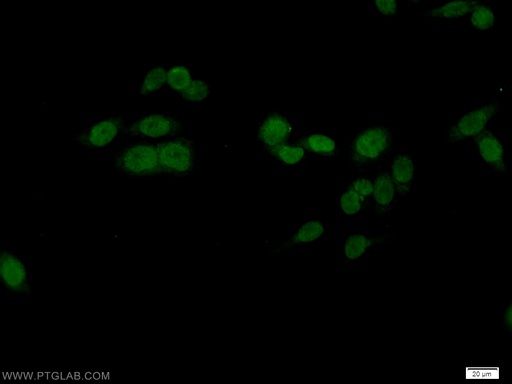 [10387-1-AP-150UL] OCT1 Polyclonal antibody