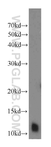 [10388-1-AP-20UL] DNAL4 Polyclonal antibody