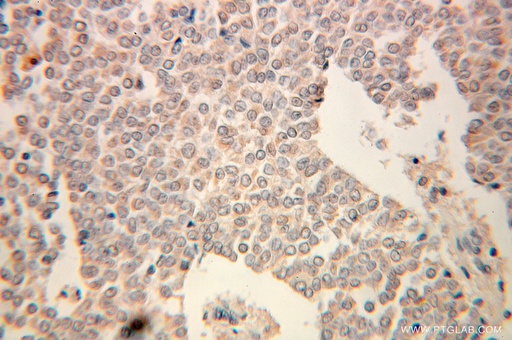 [10391-1-AP-150UL] UGP2 Polyclonal antibody