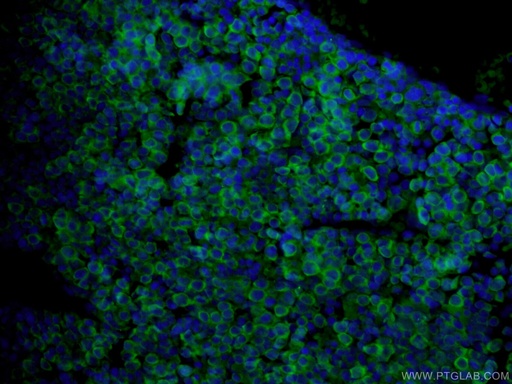 [10392-1-AP-150UL] USP2 Polyclonal antibody