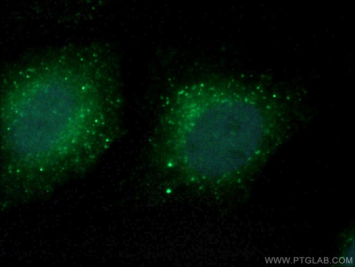 [10393-1-AP-150UL] COMMD5 Polyclonal antibody