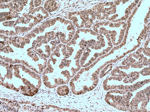[10398-1-AP-20UL] BAP1 Polyclonal antibody