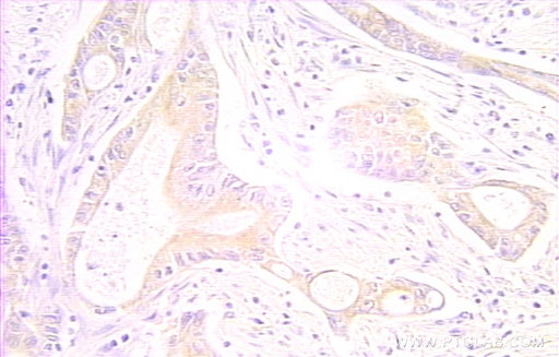 [10401-1-AP-20UL] RAIDD Polyclonal antibody