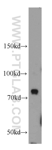 [10402-1-AP-150UL] BCAS3 Polyclonal antibody