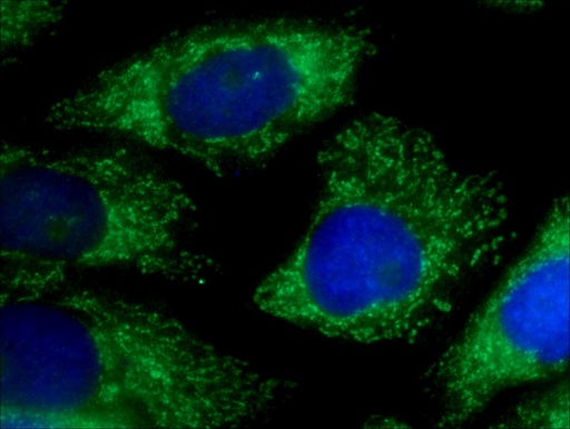 [10403-1-AP-20UL] ICT1 Polyclonal antibody