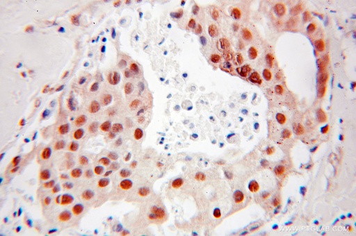 [10406-1-AP-20UL] DR1 Polyclonal antibody
