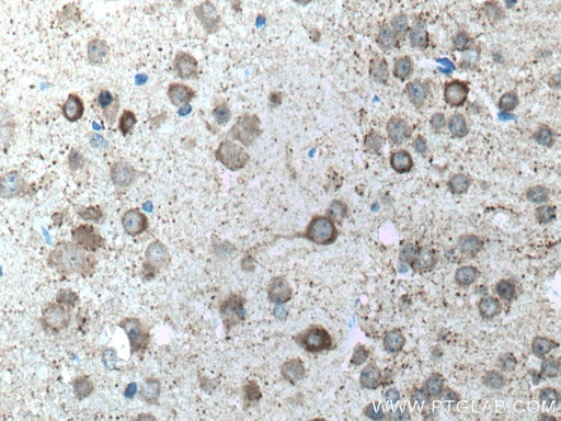 [10408-1-AP-150UL] GAD1 Polyclonal antibody