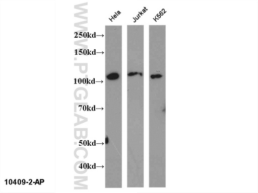 [10409-2-AP-150UL] NFKB2 Polyclonal antibody