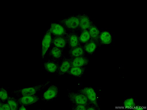 [10410-1-AP-150UL] RFC2 Polyclonal antibody