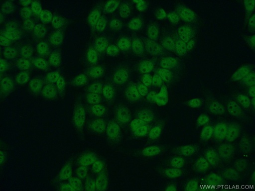 [10412-1-AP-20UL] RPA2 Polyclonal antibody