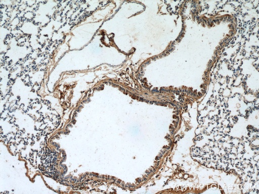 [10413-1-AP-150UL] PLUNC Polyclonal antibody