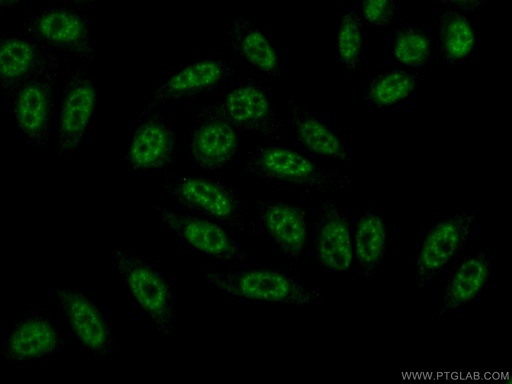 [10414-1-AP-20UL] BCAS2 Polyclonal antibody
