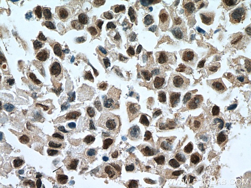 [10417-1-AP-150UL] GATA3 Polyclonal antibody